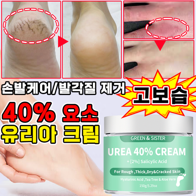 유리아 크림 우레아 풋크림 100% 함익병 유레아 크림 발 뒷꿈치 보습크림 발각질 제거 피부연화제 고보습 풋크림, 150g, 1개, 1개입