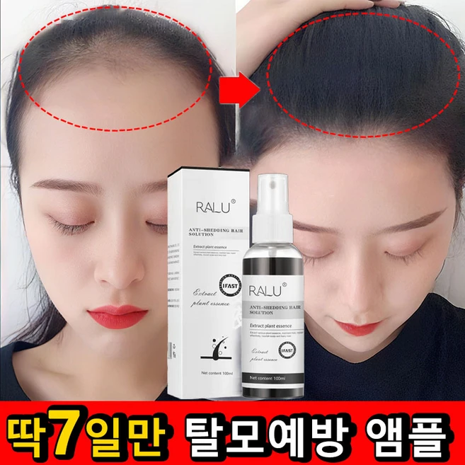 [탈모방지99%] 1/1+1 탈모 앰플 두피 탈모 예방 영양제 모발 활력 증진 성장 헤어 에센스, 2개, 100ml - 쿠팡