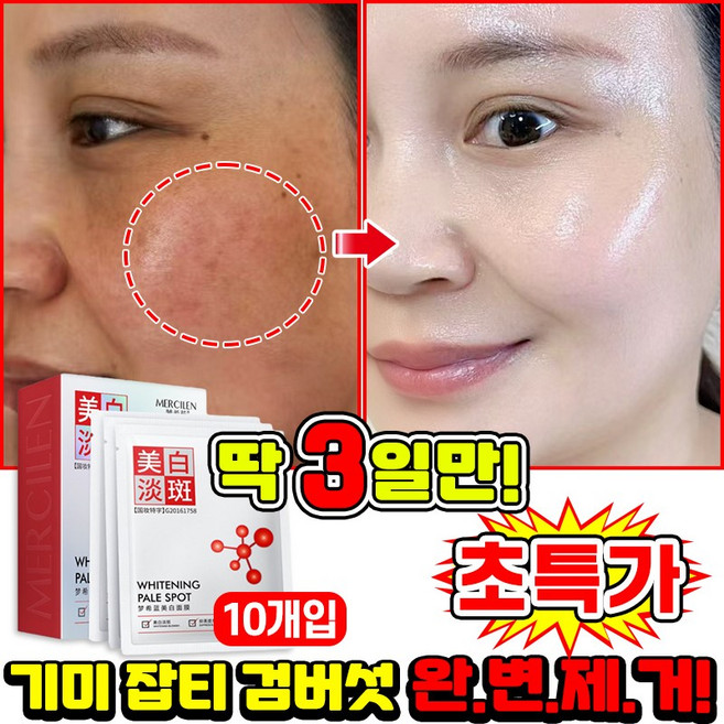 [빠른효과] 10/10+10/20+20 기미 패치 기미팩 얼굴 멜라논 미백 마스크팩 기미 잡티 검버섯 주근깨 제거 마스크팩 색소침착 화이트닝, 1개, 10개입