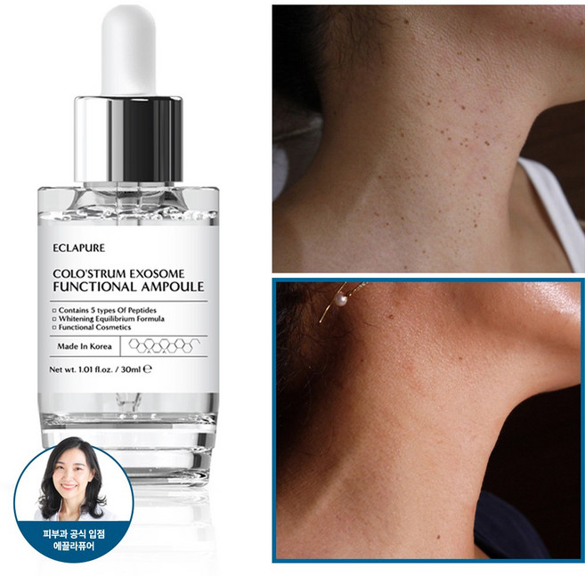 에끌라퓨어 요철 개선 유산균 앰플, 1개, 30ml