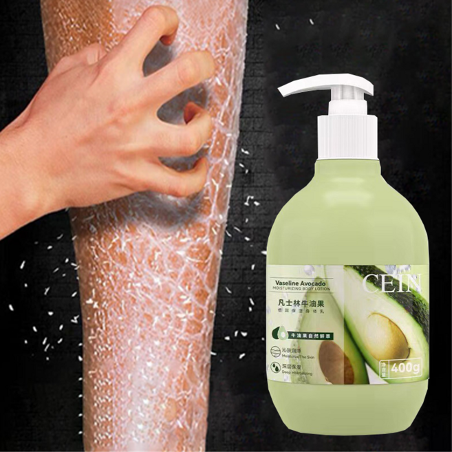 Bellamone고보습 바디로션 추천 아보카도 유레아 바디로션 촉촉한 전신 수분 케어와 보습 강화는 물론 각질 제거와 건조로 인한 탈피 부위 진정 복원까지 도와주는 크림, 1개, 400ml