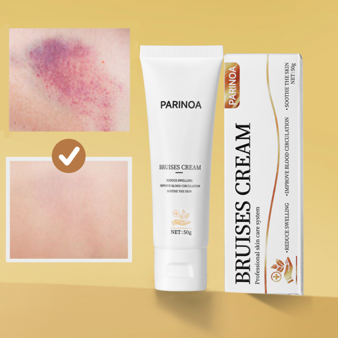 흔적 진정 멍 케어 크림 아르니카 멍 연고 리커버리 크림 멍 붓기완화 올인원, 1개, 50g