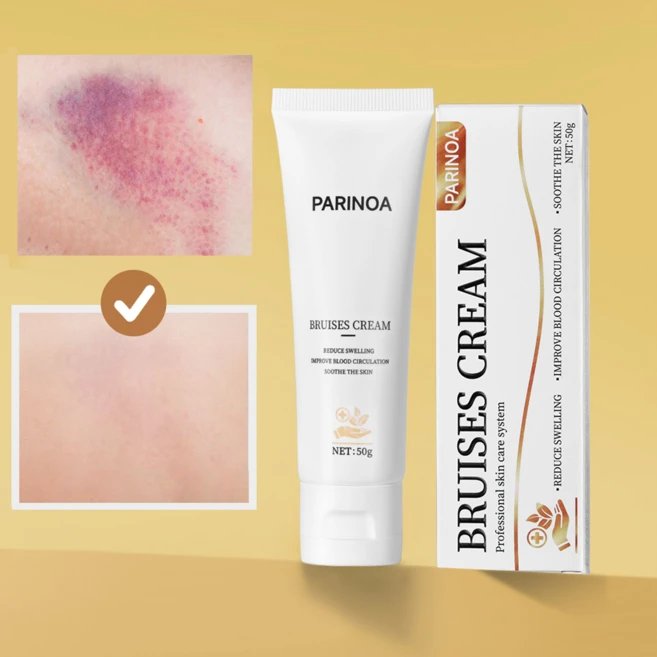 흔적 진정 멍 케어 크림 아르니카 멍 연고 리커버리 크림 멍 붓기완화 올인원, 1개, 50g - 쿠팡