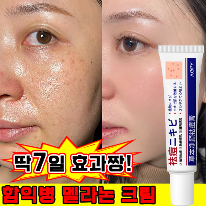 함익병 기미크림 멜라논 크림 함익병 기미 잡티 제거 크림1위 착색크림 얼굴 색소침착 화이트닝 피부 재생크림 보장증정, 4개, 20g
