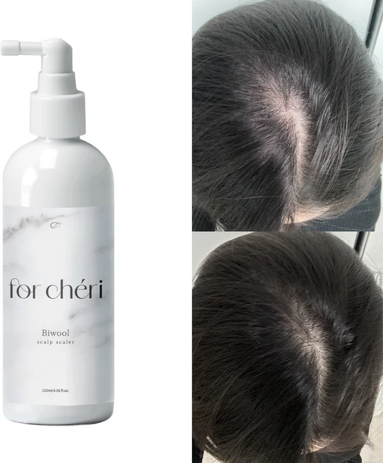 포셰리 뾰루지완화 비듬제거 저속노화두피스케일링 비울, 1개, 120ml - 쿠팡