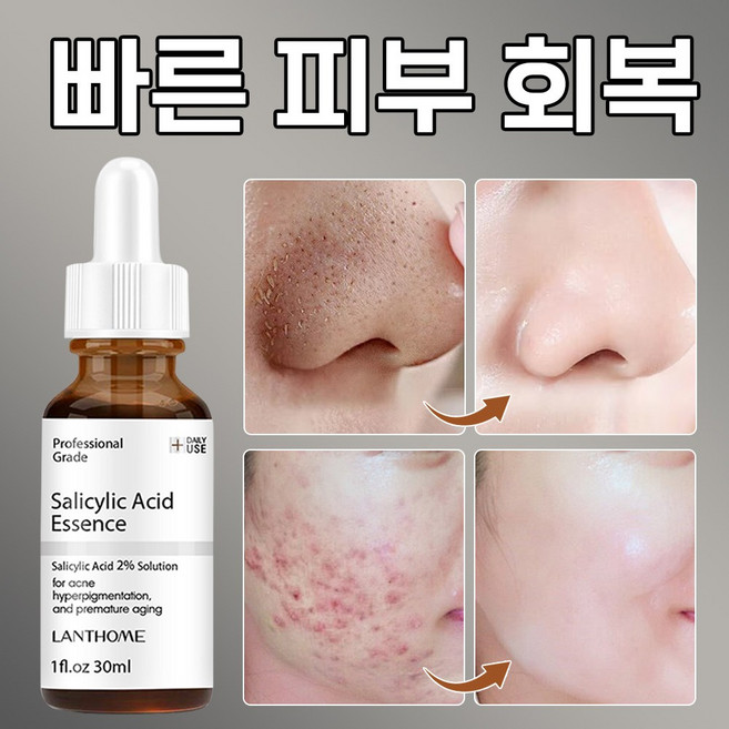 [여름 대표 필수품]코 피지 제거 모공 앰플 얼굴각질제거 피지 연화 앰플 피지연화제 모공축소 앰플 피지연화제 각질연화제 블랙헤드 제거 모공면적감소 피지감소 살리실산 앰플, 2개, 30ml