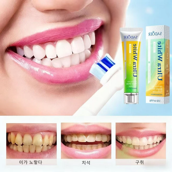 미백치약 치석제거 황치제거 담뱃때제거 충치예방 상큼한 입김 미백 치아 구취 제거 잇몸 민감도 개선, 5개, 5개  100ml - 쿠팡