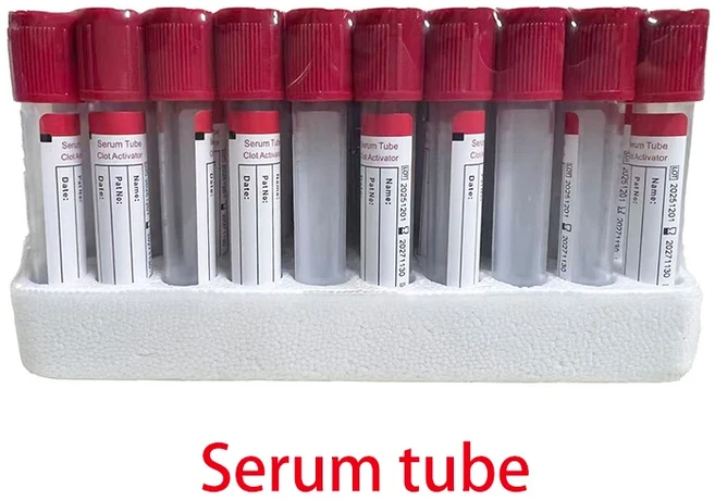2.7ml/4ml 멸균 완충 시트르산나트륨 1:9 혈액 채취 응고 튜브 100개 플라스틱 애완동물 실험실 용품, 01 4ml Plastic Tube