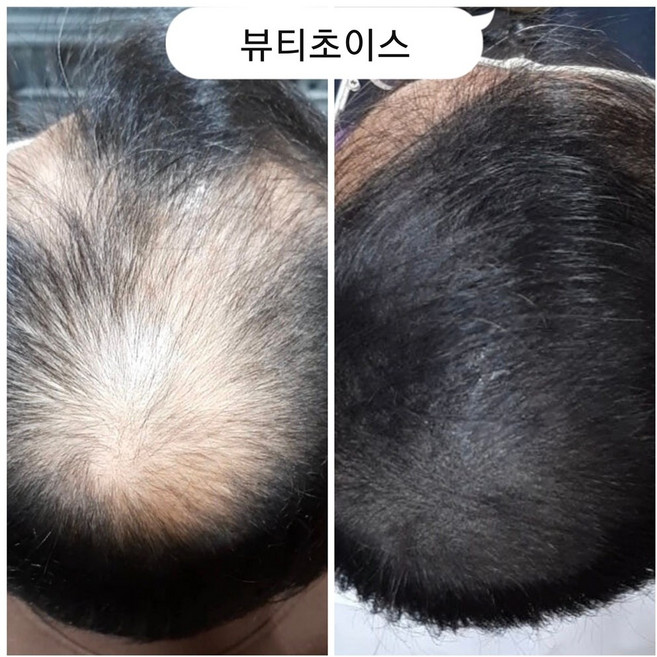 SMP 탈모커버 정규교육 (주1회 3시간 10회 교육)-﻿SMP 전문 실전교재 제공 및 포트폴리오 포함, 1개, 무향