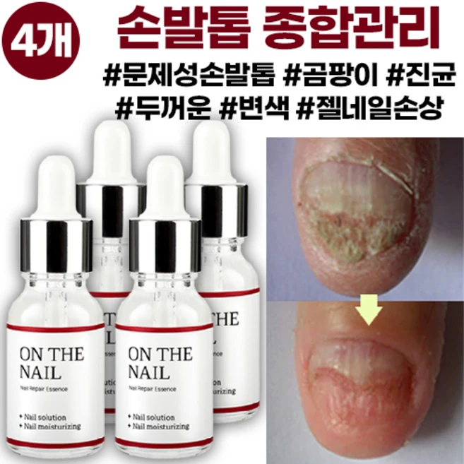 비비룩 온더네일 에센스, 20ml, 4개 - 쿠팡