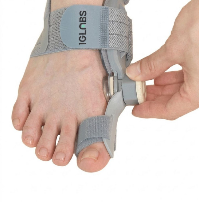 이그랩스 각도조절 무지외반증 발가락 교정기 의료기기, 1개
