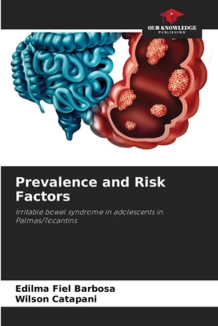 (영문도서) Prevalence and Risk Factors Paperback, Our Knowledge Publishing, English, 9786206204466
