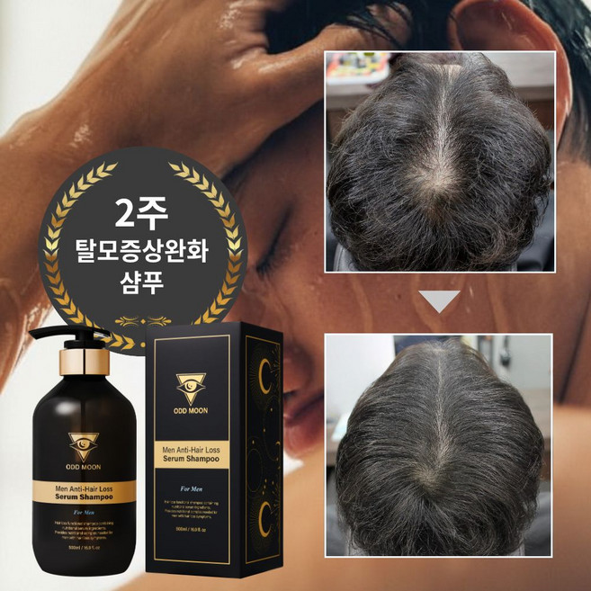 2위 - 2주 완성 오드문 탈모 세럼 샴푸, 2개, 맨(남성), 500ml