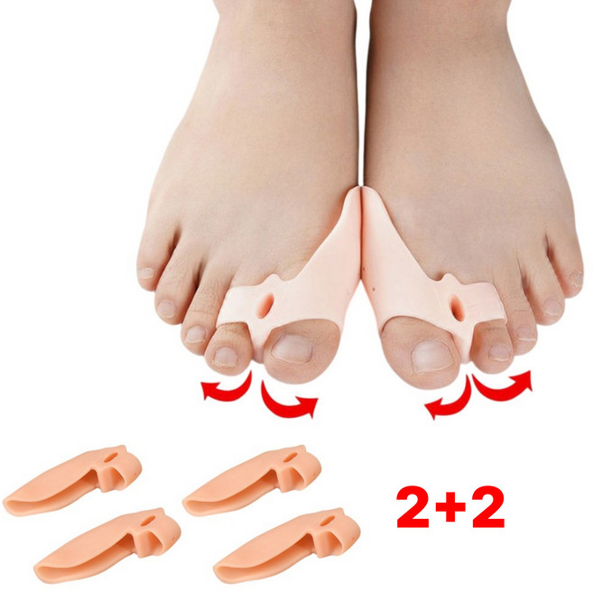 별오점 엄지 발가락 교정기 실리콘 끼우개 4개, 1세트