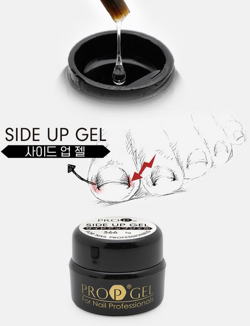 아루무 네일 사이드 업 젤 5g (366) 내성 손발톱 교정 젤, 1개