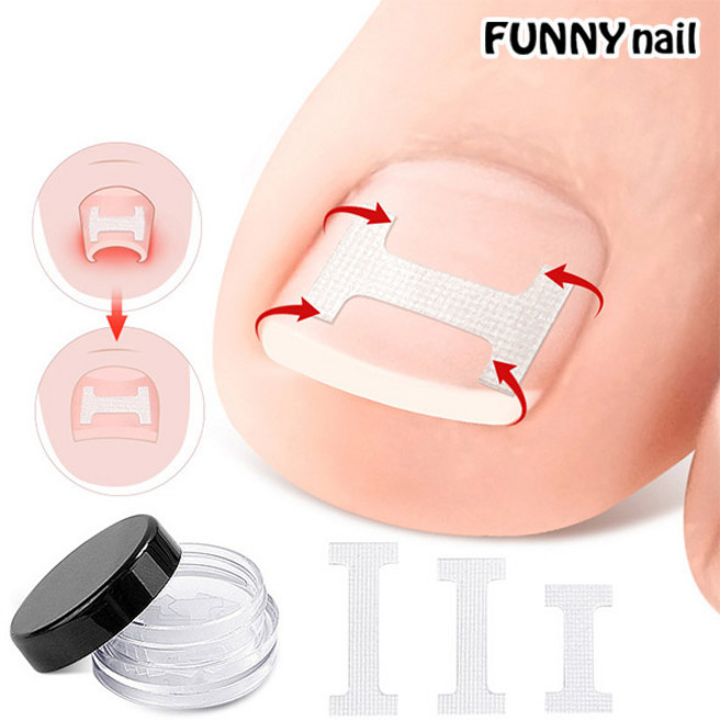 [퍼니네일] 발톱케어팁 10pcs 3가지 사이즈 파고드는 발톱 케어밴드팁, 1개, 발톱 케어팁 10pcs - 02