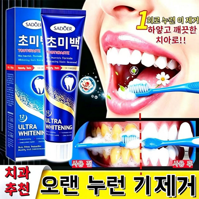 [당일 배송][효과 보장] 치과 추천 1위 미백 잇몸 재생 치약 약국 전용 잇몸치약 치주염 잇몸붓기 이빨 염증 개선 프로바이오틱스 치태 제거 미백 치약, 1개, 100g