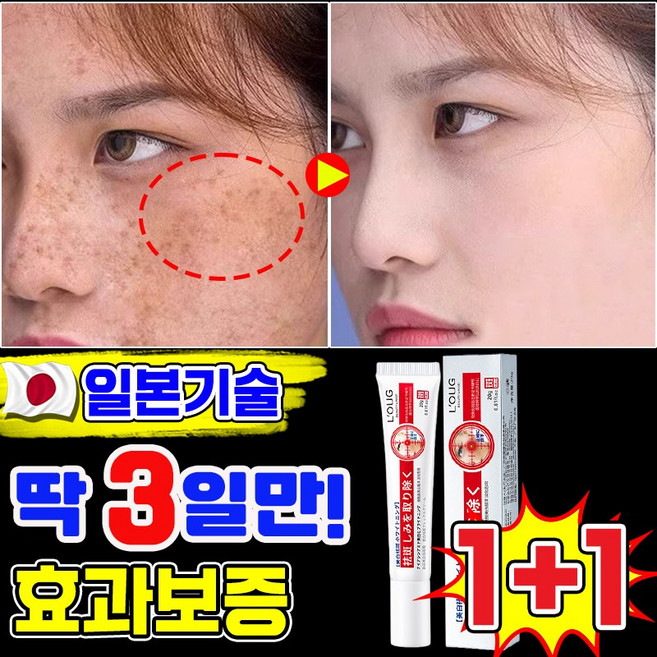 일본기술 기미크림 기미 잡티 검버섯 흑자 제거크림 멜라논 멜라닌 크림 착색 미백 크림 색소침착 LUPEIYA 포장증정, 2개, 20g