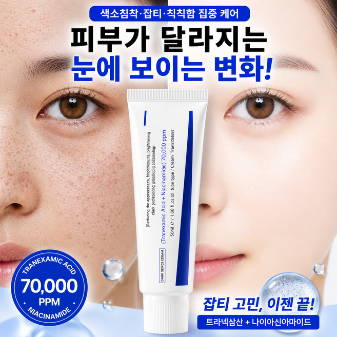 (고함량) 나이아신아마이드 락티스 크림 젖소크림 얼굴 미백크림1위 기미 주근깨 미백개선 트라넥삼산 미백 탄력 크림 NMN 피부 진 컨디션 케어 함익병 멜라논 크림 여성 영양크림, 1개, 100ml