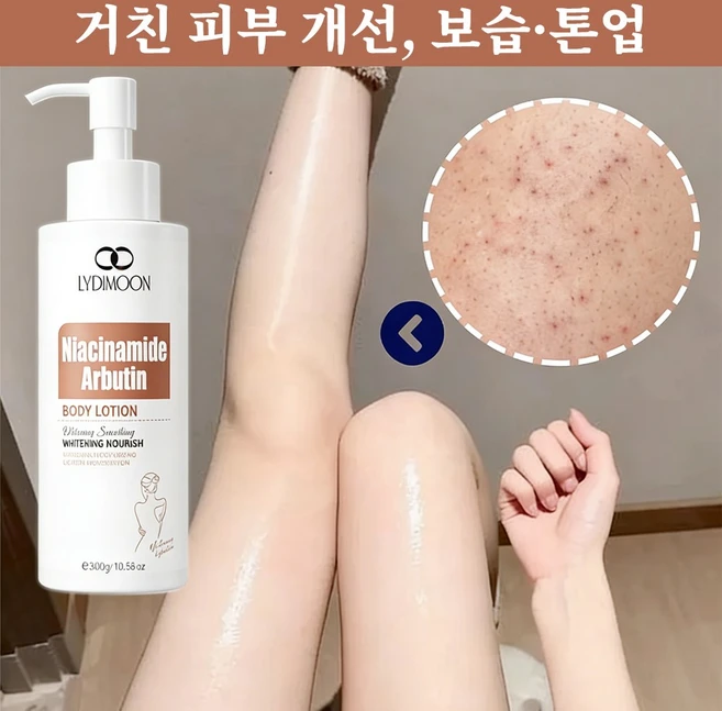 나이아신아마이드 알부틴 바디 로션 Niacinamide Arbutin Body Lotion 미백 보습 피부 피부 색소 침착 완화, 1개, 300g - 쿠팡