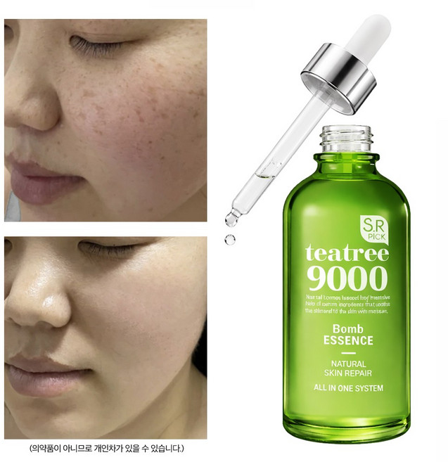 나이아신아마이드 앰플 비타민 티트리 미백앰플 세럼 에센스 기미 잡티 색소침착 모공, 1개, 50ml