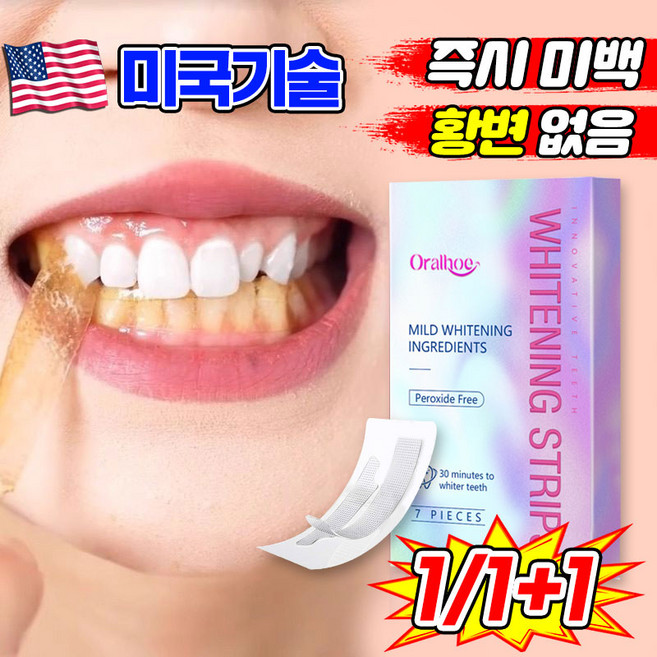 [즉시 미백] 치아 화이트닝 스트립 치아미백 패치 치아미백제 치아미백 테이프 스티커 구취 치석 누렁니 얼룩 제거 포장 증정, 1개