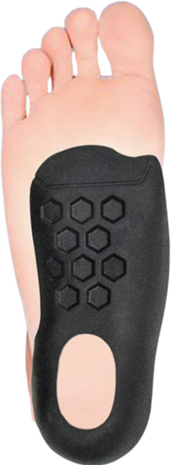 오다리 교정 보조 기능성 평발 아치 깔창 뒤꿈치 패드 족저근막염, 블랙(좌1개+우1개)