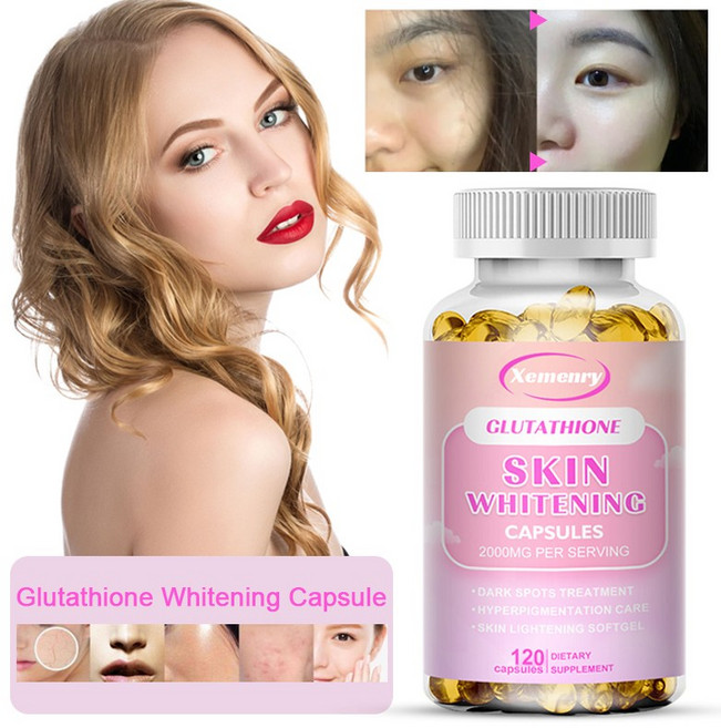 피부 관리 면역 건강 보호 항산화 지원 여성 및 남성을 위한 노화 방지 보충제를 위한 피부 미백 캡슐, 1개, 30정