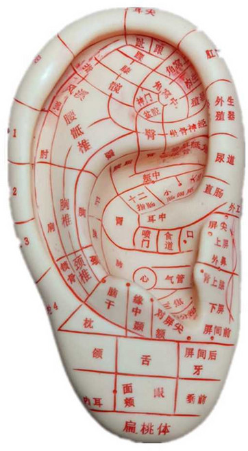 귀모형 지압점 귀모형혈자리 교육 건강 침술 경혈, 1개, 17cm 귀침모형+귀 스티커+족집게+수동