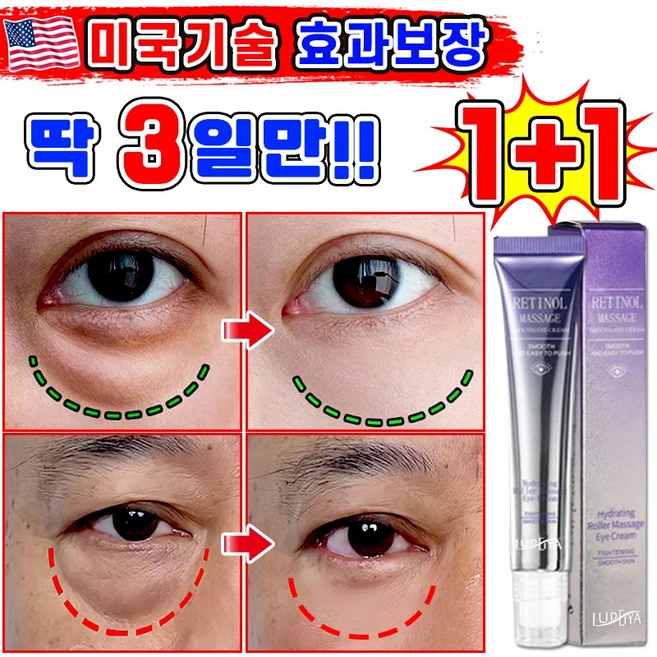 [효과보장] 1/1+1/2+2 아이백 리프팅 900샷 아이크림 눈 밑 지방 볼륨 개선 눈밑지방 제거 아이백 크림 다크서클 눈밑꺼짐 제거 아이케어 LUPEIYA 포장증정, 2개, 20g - 쿠팡