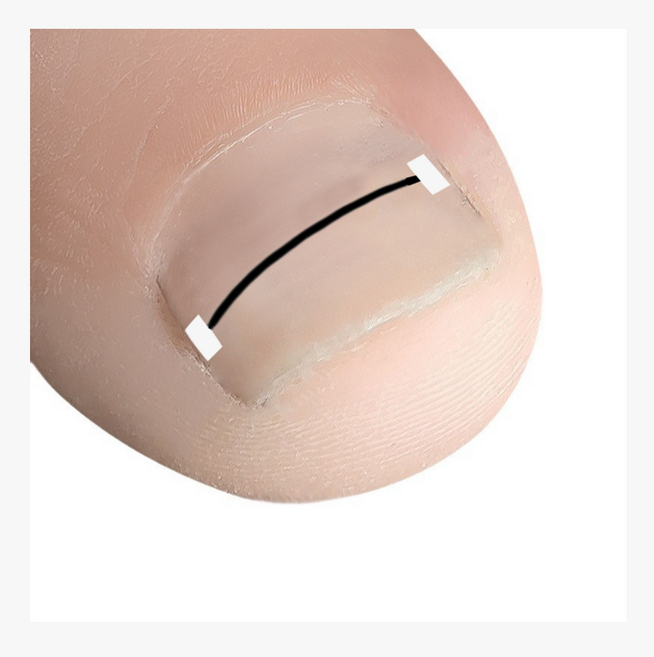 신짱컴퍼니 부러지지 않는 탄력최고 와이어팁, 1세트, 풀세트와이어팁18mm