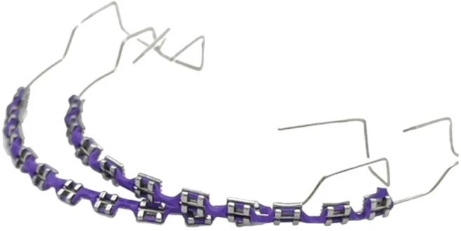 트렌디한 교정기 주얼리 세트 2개 | 화려한 치아 교정기 반짝이 체인 | 소녀 및 청소년을 위한 치아 교, 02 Purple