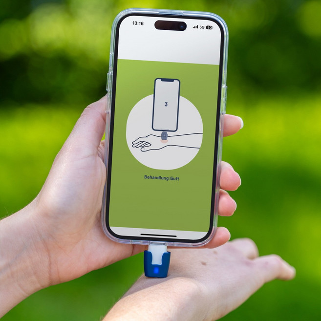 [히트잇] 모기물린 가려움 솔루션/ 식약처 의료기기/ 독일생산 [USB-C 타입], 1개