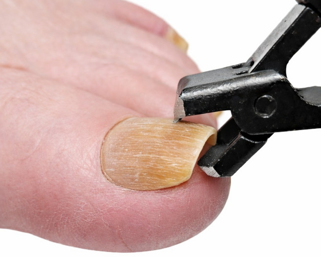 로비첸 [강력절삭] 두꺼운 발톱깎이 특대형 노인 손톱 깍기 문제성, 1개, 다크 블랙