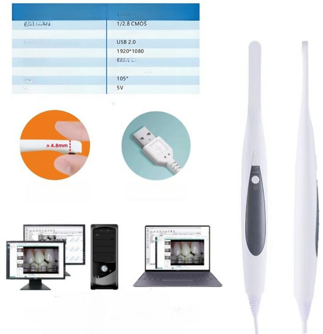 구강 내시경 휴대폰 화소 이빨 충치 안드로이드 배관 입안 현미경 스캐너 치석, 유선 핸들 모니터 미포함 노트북 전용, 1개, 기본 색상