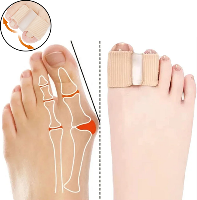 휘어진 발 무지외반증 교정 탄성밴드, 4개