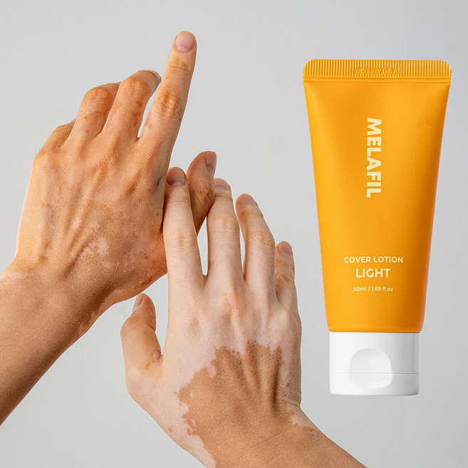 멜라필 백반증커버 로션 크림 백반증커버제 피부 흰색반점 커버제 컨실러 태닝메이크업 백반증태닝, 라이트, 1개