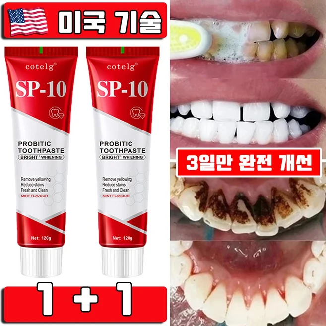 미국 1/1+1 SP10 미백 치약 누렁니 제거 입냄새 제거 프로바이오틱 화이트닝 미백 치약 치아미백 대용량 프리미엄 사은품 랜덤 증정, 2개, 120g - 쿠팡