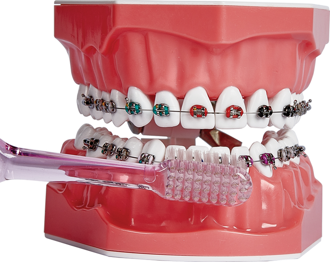 AM060 양치교육 교정 모형/ 브라켓 교정/ 치아 설명 올바른 칫솔질 양치질 교육 교구 이빨 모형
