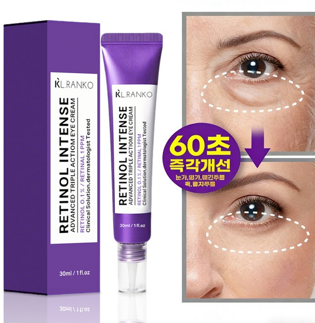 눈밑지방과 다크서클 다크서클 아이크림 추천 눈밑꺼짐 리프팅 크림 눈밑주름 개선 아이크림 눈밑지방 제거 크림, 1개, 30g