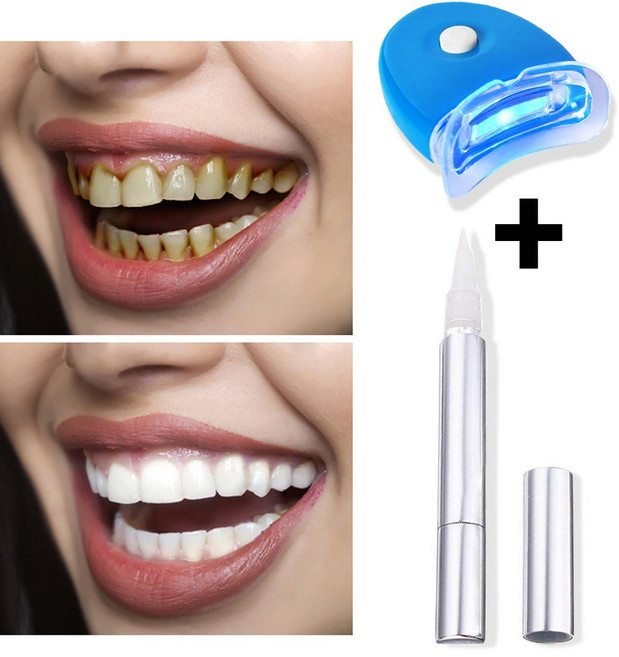 셀프미백키트 치아 미백제 미백겔, 1개