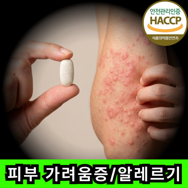 JUAREN 피부 알레르기 두드러기 가려움증 면역력, 1개, 60정