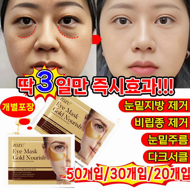 2위 - [국내배송] 50개/30개20개/ 눈밑지방 제거 아이 패치 아이백 다크서클 눈밑꺼짐 눈밑주름 제거 팔자 주름