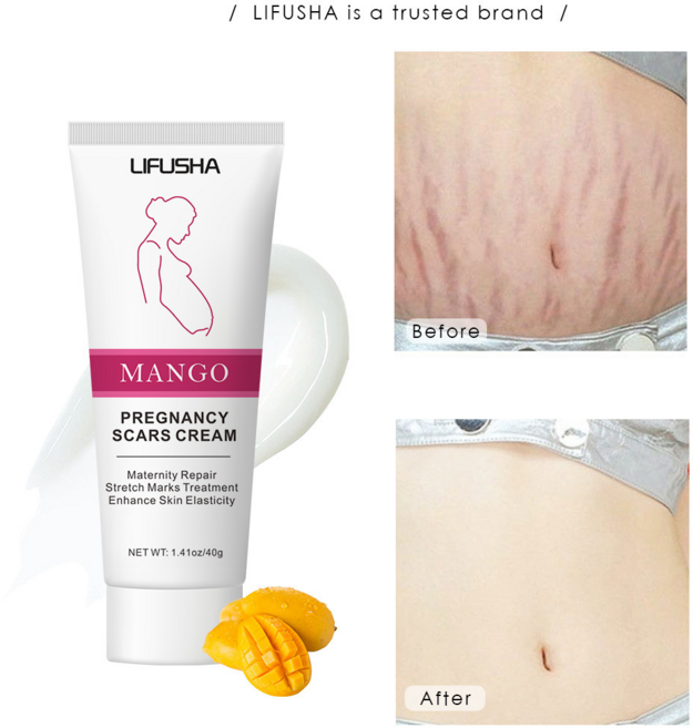 튼살 크림 임산부크림 임산부 전용 안전하다 부담제로 전문관리, 4개, 40g