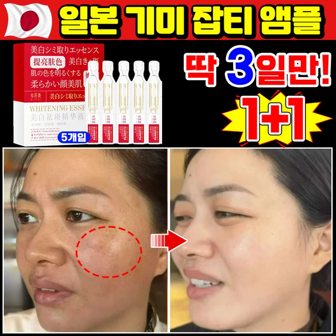 [100% 효과있음] 1/1+1/2+2 기미 미백 앰플 잡티 주근깨 검버섯 제거 세럼 비타민c 앰플 멜라논 에선스 화이트닝 색소침착, 2개, 10ml - 쿠팡