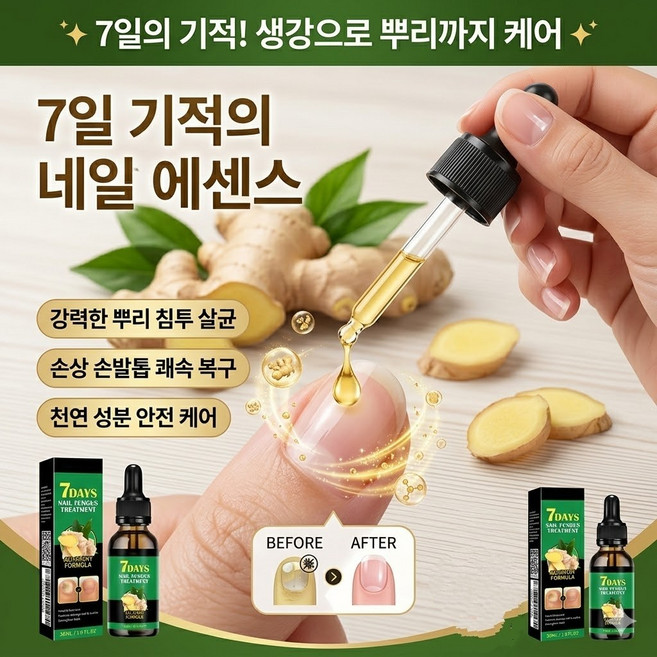 네일수리 영양 앰플 솔루션 곰팡이발톱 문제성발톱 관리 항균항염 손발톱 케어제 1개 30ml, 30ml × 1개