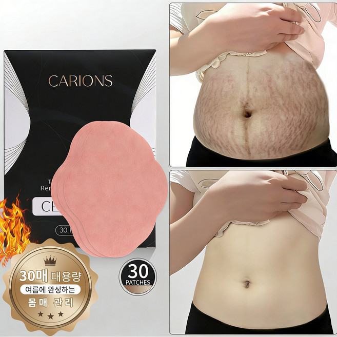 [다이어트 /셀룰라이트패치 ]10일의 기적 뱃살 집중 슬리밍패치 복부 집중 케어 셀룰라이트 제거 노폐물 배출 붓기 완화까지, 1개, 30개입