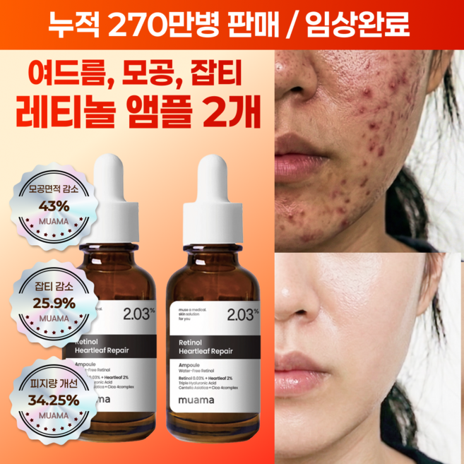 여드름성 피부 사용 적합 사춘기 트러블 진정 개선 흉터 모공감소 피지연화 5종 임상완료 [누적 270만병] 고함량 나이아신아마이드 레티놀 어성초 히알루론산 뮤아마 앰플 세럼, 2개, 30ml