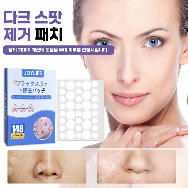 기미 패치 점버섯 잡티 주근깨 제거 크림 비타민C 화이트닝, 1개, 148개입 - 쿠팡