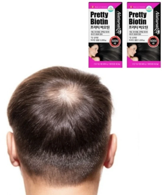 내추럴라이즈 프리티 비오틴, 2개, 100정 - 쿠팡